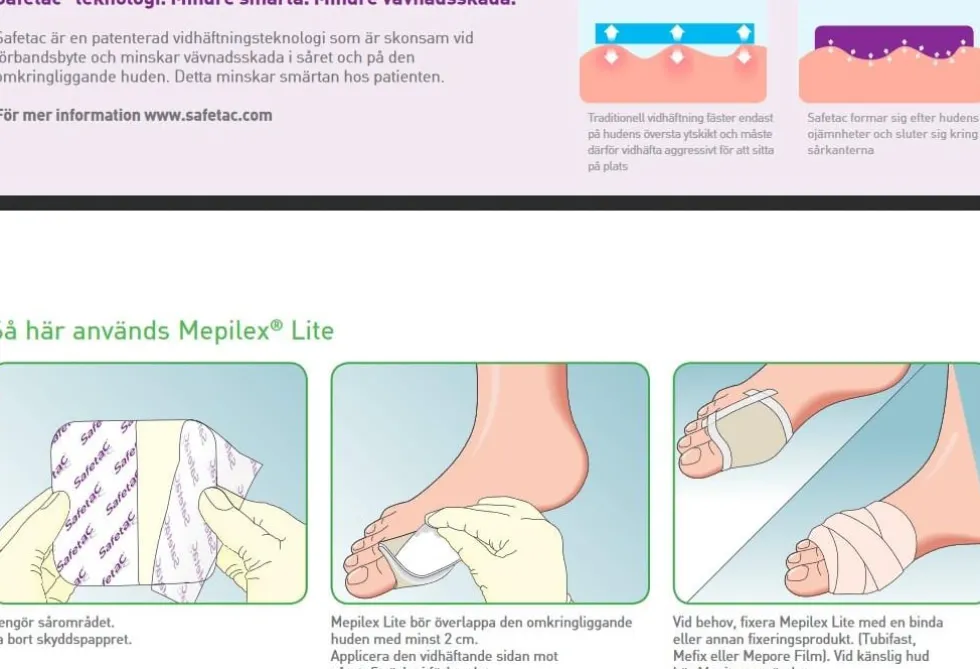 Mepilex Lite 10x10cm 5/FP